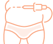 Abdominoplastie et Liposuccion